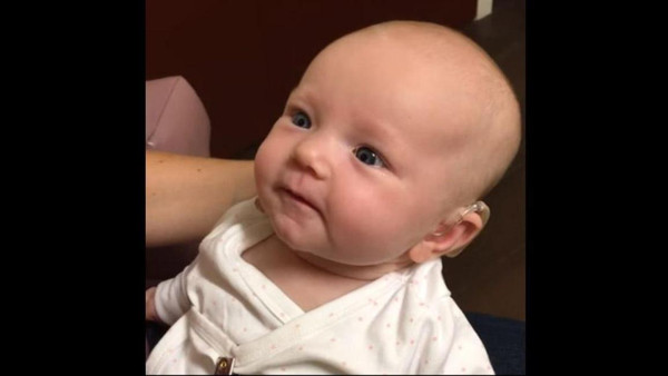 لحظات مؤثرة لرضيعة صمّاء تسمع صوت