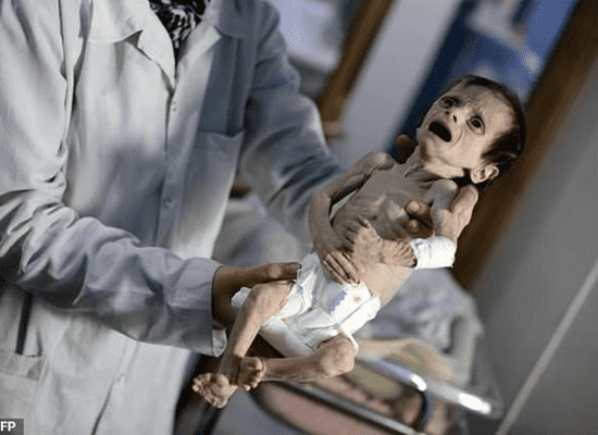 صور صادمة لرضيعة سورية تجتاح مواقع