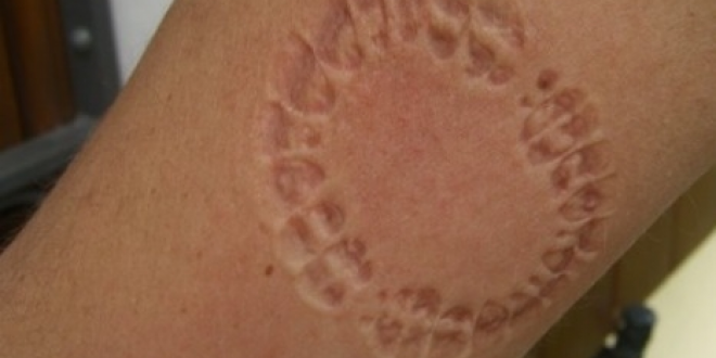 شخص ’يعض‘ معلمة داخل حرم المدرسة..