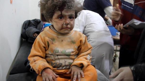 بالفيديو.. أن تشاهد الموت في عيني