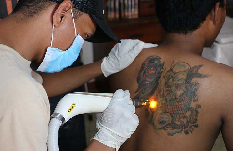 إندونيسيا.. مبادرة لإزالة الوشوم مقابل حفظ