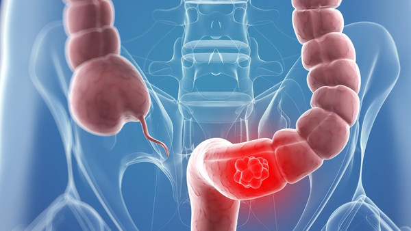 تناول الخضراوات بكثرة يقلل احتمال الوفاة