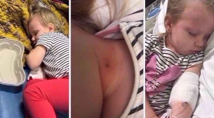 طفلة تصارع الموت بسبب خدش قطة