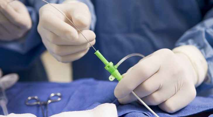 طبيب اردني يجري قسطرة للصمام التاجي