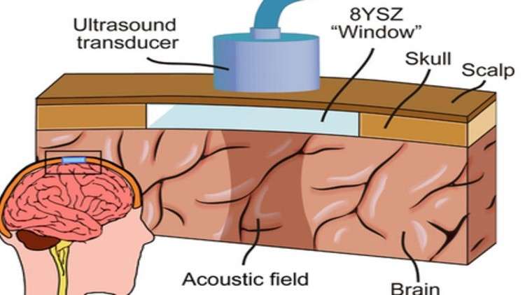 لأول مرة.. الأمريكيون دخلوا مخ الإنسان