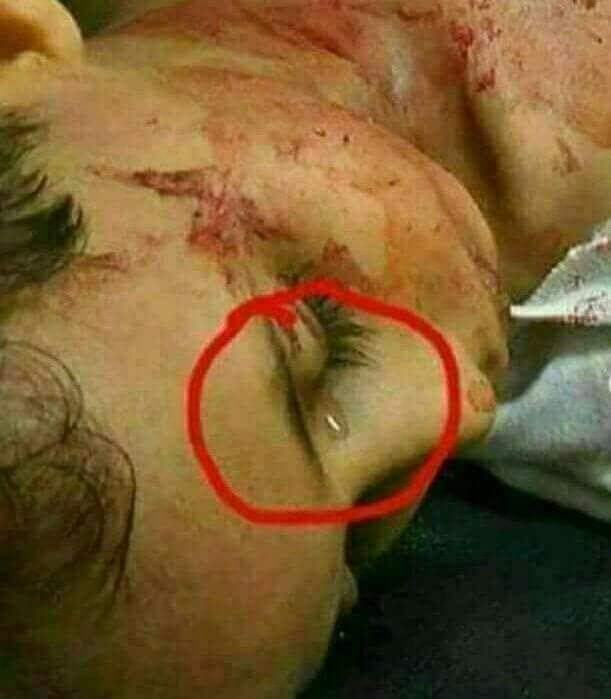 مصريون مصدومون من صورة طفل فارق