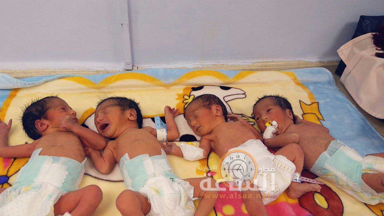 مستشفى الحكمة بالزرقاء يسجل انجازا طبيا..