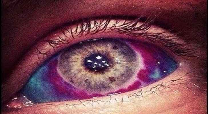 أغرب الحوادث الطبية لعام 1634 1632