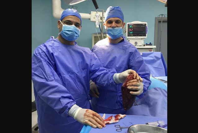 الطبيب الرواشدة يستأصل كتلة سرطانية على