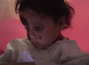 أحرق الصقيع وجهها وصارعت الموت لساعات