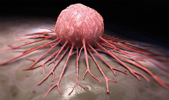 2852 امرأة مصابة بالسرطان في الأردن