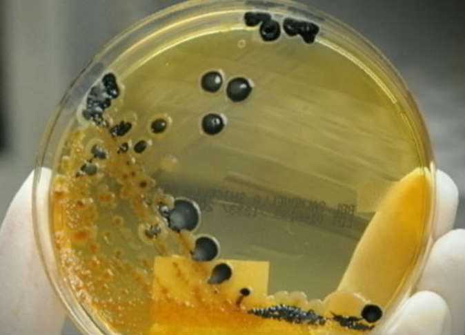 بكتيريا خطيرة تنتشر عالميا