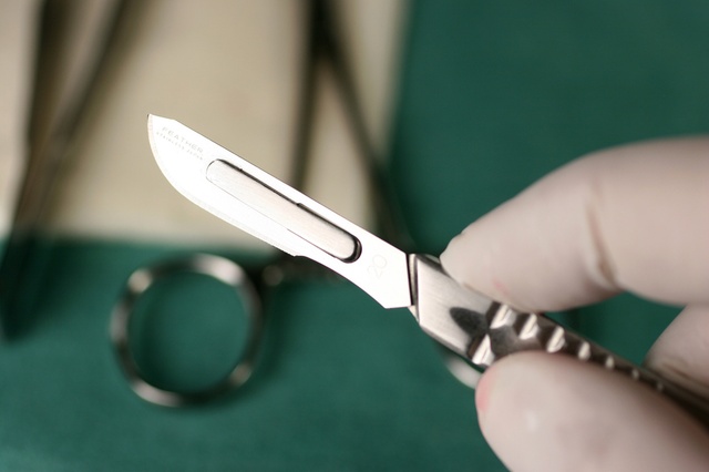 أردني يقاضي والده بسبب الختان وفقا