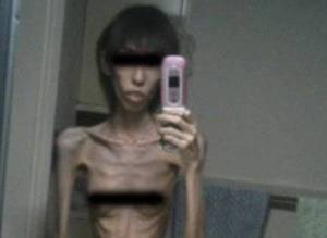 منع عنها الطعام 10 سنوات ..