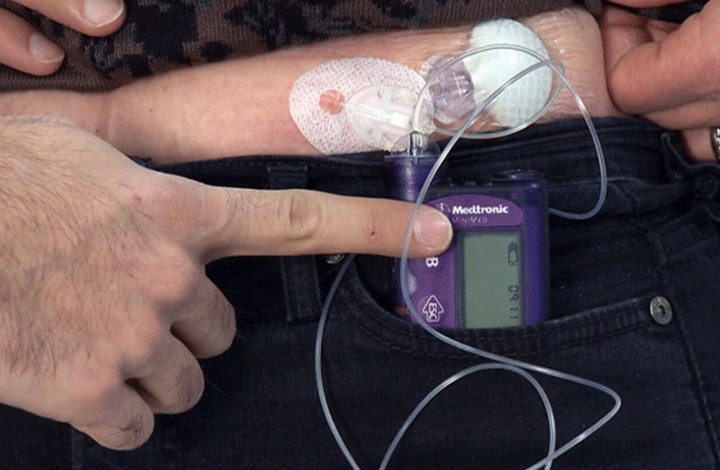 بشرى لمرضى السكري