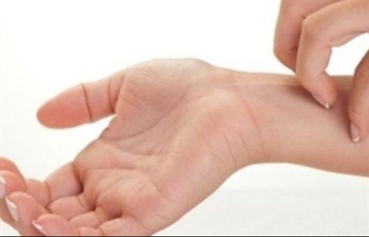 أكاديمية أردنية تسجل مرضا جلديا نادرا