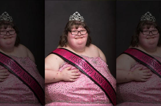 ملكة جمال وزنها 172 كيلوغراما