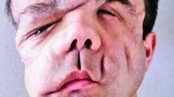 بالصور.. أول رجل في العالم عاش