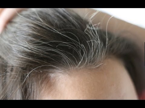 لماذا نشيب.. العلماء وجدوا إجابة جديدة