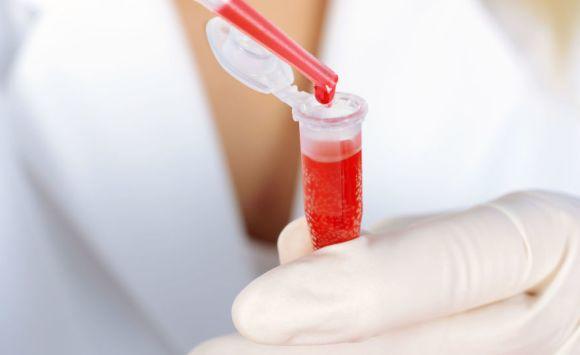 موهبة غريبة لرجل أسترالي