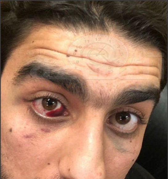 هذا هو المواطن الذي ادّعى الاعتداء