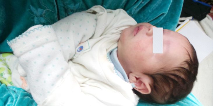 وفاة رضيع في شهره الثالث جراء