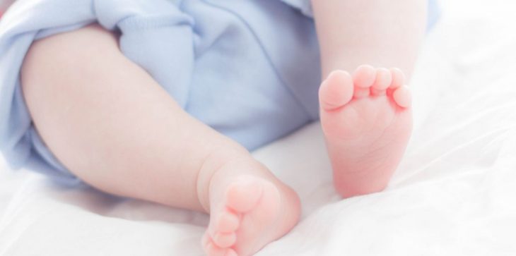 بالصور.. ولادة طفل بوجهين في رأس