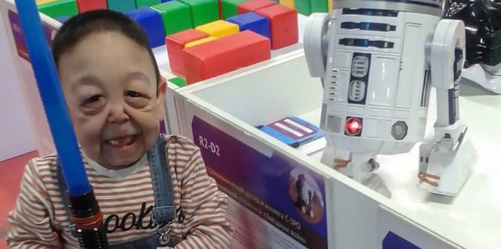 مرض نادر يحوّل طفلا عمره 6