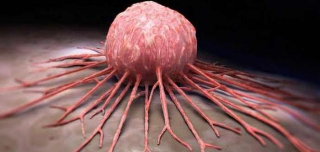 سرطانا ’القولون والمستقيم‘ الأكثر انتشارا في