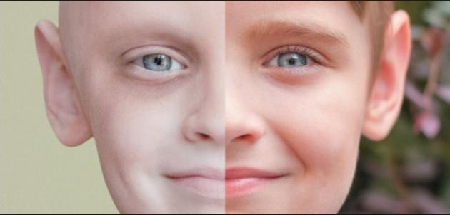 تقرير: 18 مليون حالة سرطان جديدة