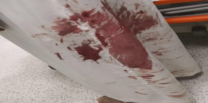 السعودية.. مريض نفسي يغادر المستشفى ويطعن