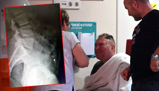 لص يبتلع خاتم ألماس (فيديو)