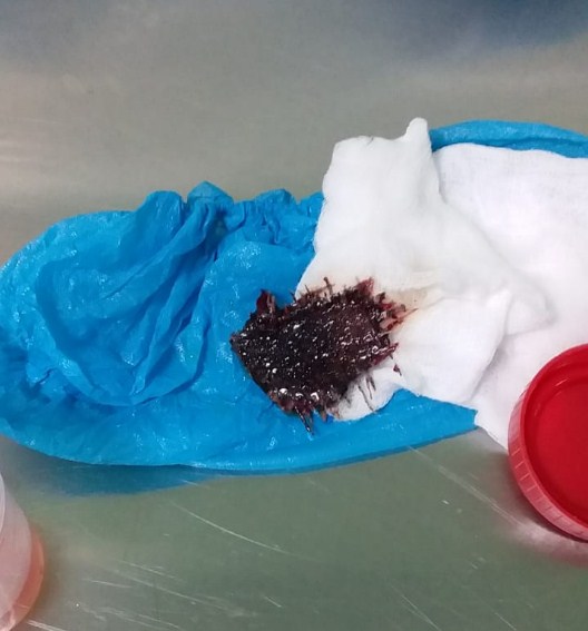 فريق طبي مشترك يجري عملية طارئة