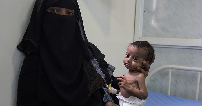 «المجاعة» تهدد 14 مليون شخص في