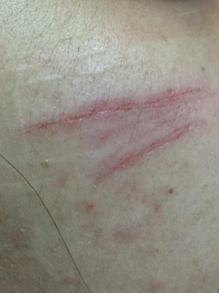 معلمة تعتدي على طالبة في إربد