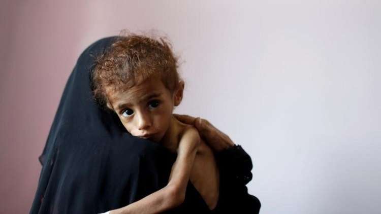 مسؤول أممي: اليمن على شفا كارثة