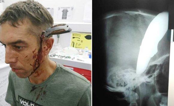 شاب ينجو من الموت بعد غرز