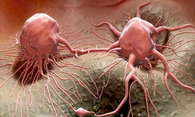 عقار جديد لمعالجة مرض السرطان من