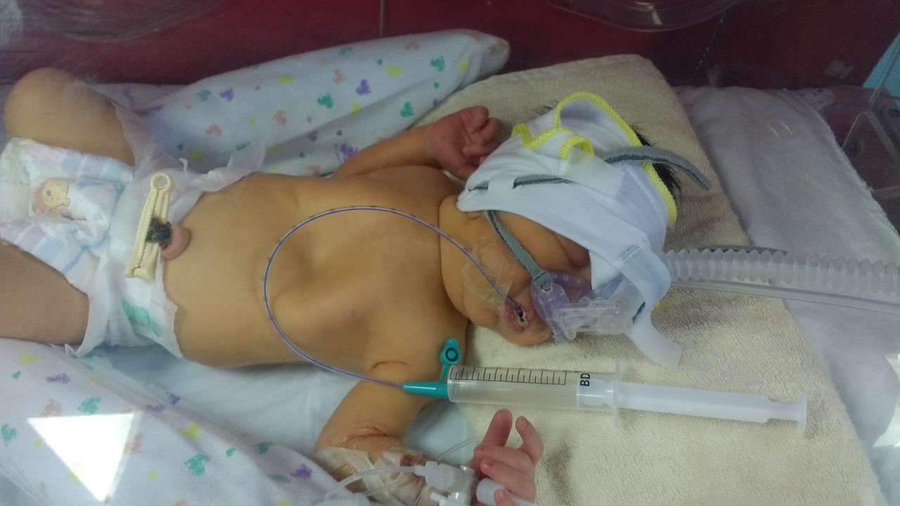 نعم، عبدالله طفل محظوظ