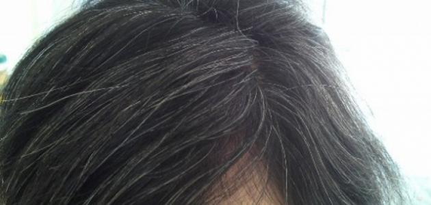 دراسة تكشف “الأسباب الحقيقية” لظهور الشيب