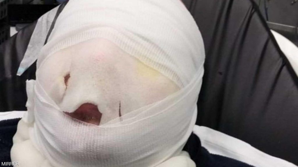 حاول أن يسلق البيض في بالمايكروويف