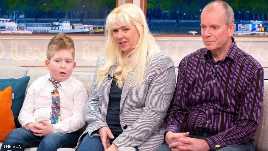 طفل بلا دماغ يحير العلماء