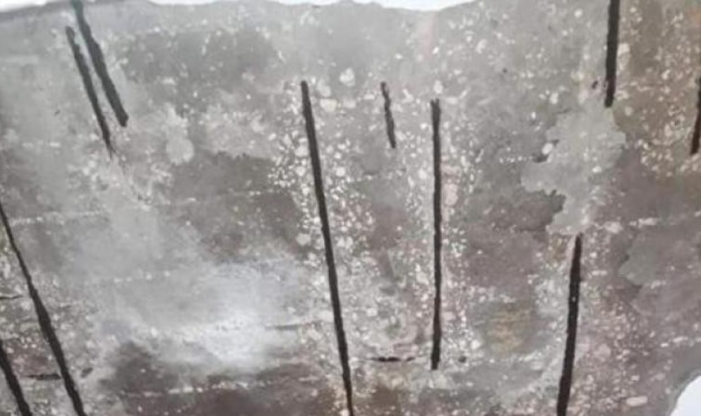 سقوط أجزاء من سقف مركز صحي