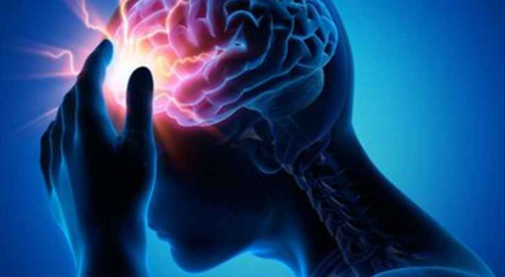 لماذا يصاب الشباب بالسكتة الدماغية؟