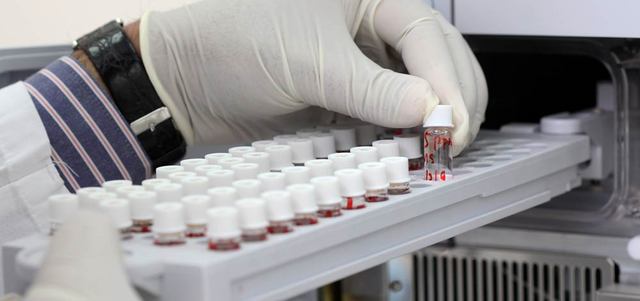 الحكومة ترفع رسوم الفحص الطبي للوافدين