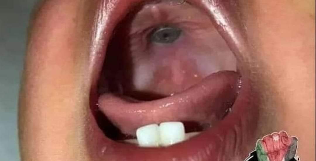 هل وضع والد طفل «برغي» في