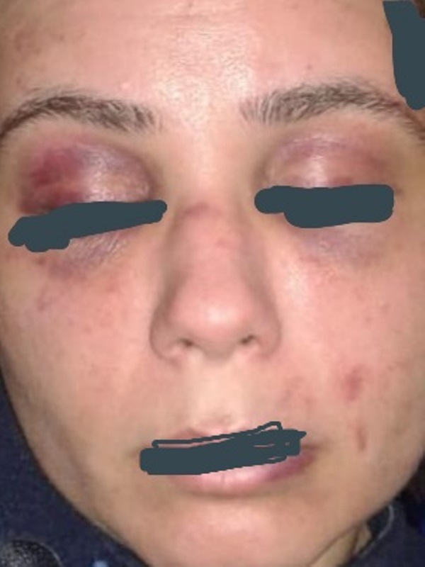 زوج في الزرقاء يربط زوجته «الأردنية