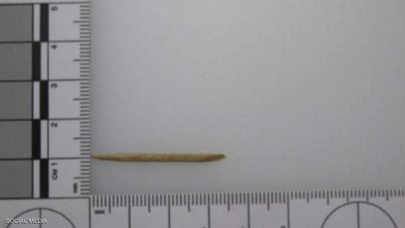 فشل طبي فادح .. عود تنظيف