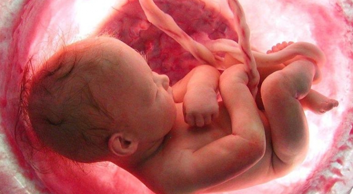 بريطانيا .. إجراء عملية جراحية لجنين