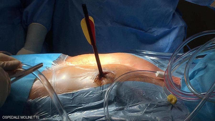 أصيب بسهم في قلبه.. وذهب للمستشفى